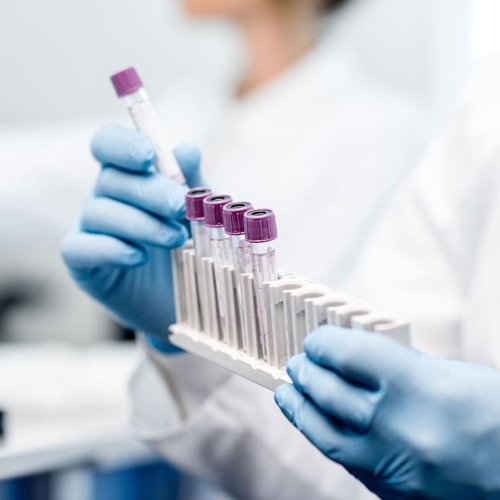 vetek labs